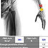 Example of maximum force and pressure threshold